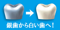 銀歯から白い歯イメージ